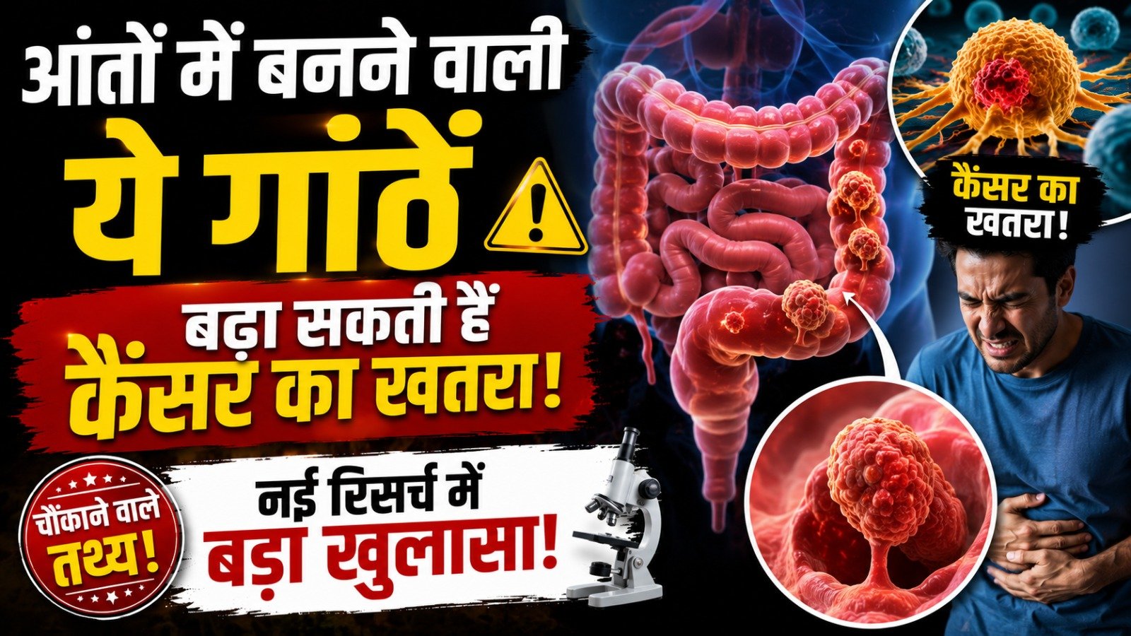 आंतों में बनने वाली ये गांठें बढ़ा सकती हैं कैंसर का खतरा, नई रिसर्च में बड़ा खुलासा…